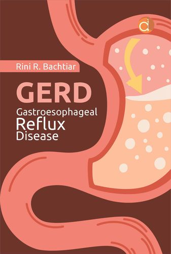 GERD Gastroesophageal Reflux Disease