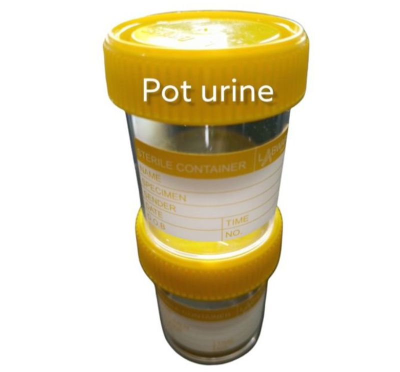Cup Sample urin