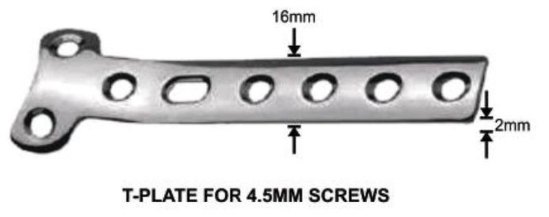 T-Plate for 4.5mm Screws